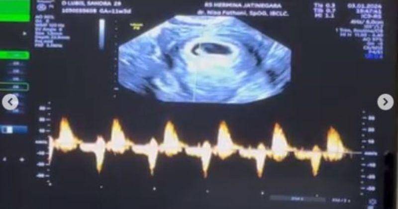 Instagram.com/sandradlubis